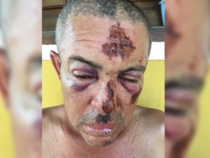 Homem é agredido pelo filho em União dos Palmares