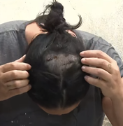 'Ele reclamou dos pratos sujos na pia', relata vítima de tentativa de feminicídio com facão em Junqueiro