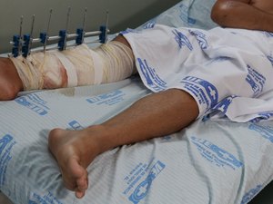 HE do Agreste tem redução de 13% no atendimento a vítimas de acidentes de trânsito