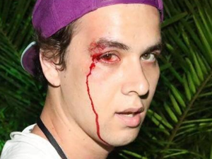 Caio Castro agride fotógrafo em festa e depois se desculpa