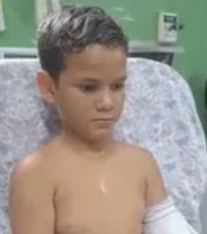 Menino de 10 anos tem parte do braço amputada após acidente na BR-316, em Maribondo