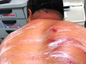 Polícia investiga se agressão a radialista foi crime de mando; sindicato repudia ação