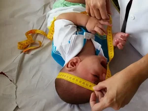 INSS pagará indenização de R$ 60 mil a crianças vítimas de zika
