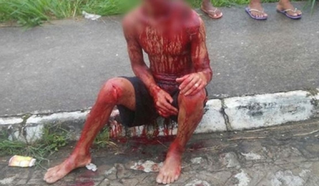 Jovem fica gravemente ferido após ser atacado a golpes de facão