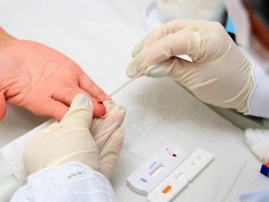 AL registra 209 casos e 14 mortes por hepatites virais nos primeiros nove meses de 2024