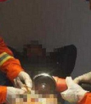 Bombeiros são acionados para retirar anel preso em órgão genital de homem