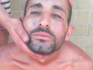Homem espancado por populares como suposto estuprador tem problemas psicológicos