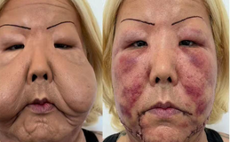 Conheça Juju do Pix, influenciadora que passa por reconstrução facial