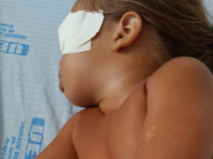 Bebê perde olho após cair na cozinha de casa, em Arapiraca