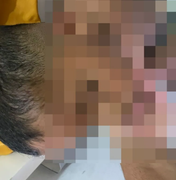 Família denuncia babá por agressões a criança autista de 5 anos em Arapiraca