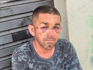 Homem é espancado durante três dias pelo próprio irmão em Palmeira