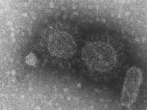 Covid-19: Brasil registra 570 casos de infecção pela variante Delta