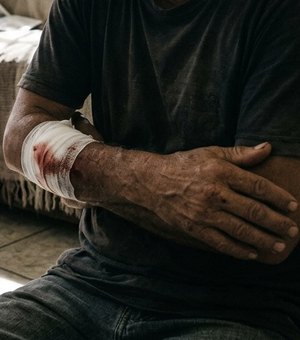 Homem é ferido com tesoura durante confusão em residência da ex-companheira