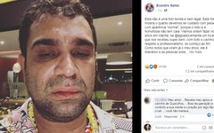 Humorista foi agredido após apresentação em Marília 