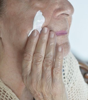 Dermatologista da Sesau orienta sobre os cuidados para evitar o câncer de pele no verão