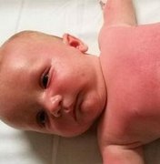 Bebê de 3 meses é internado após usar filtro solar da Peppa Pig