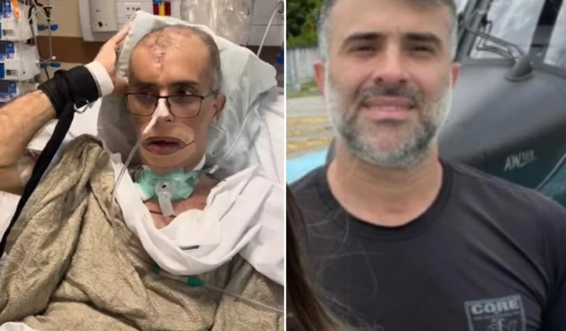 Ex-comandante alagoano apresenta avanços após ser baleado em operação no Rio de Janeiro