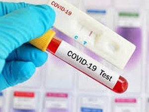  Arapiraca tem registrado média diária de 150 novos casos de Covid-19 e já soma 6.339 infectados