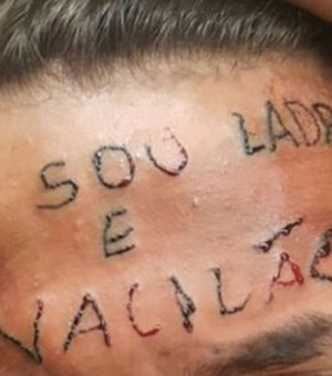 Coletivo arrecada quase R$ 20 mil para apagar tatuagem da testa de adolescente