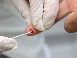 4ª edição do Governo Presente vai ofertar preservativos e testes de HIV
