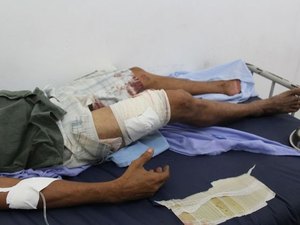 Caminhoneiro reage a tentativa de assalto e é baleado na BR-101