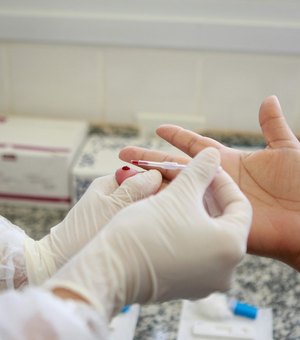 Adultos que vivem com HIV são incluídos no grupo prioritário de vacinação