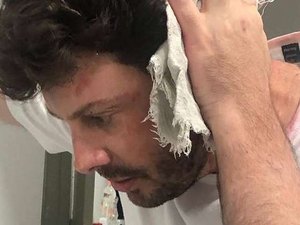 SBT esclarece que 'agressão' a Gentili era uma pegadinha