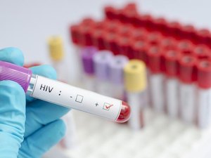 Alagoas tem a segunda maior taxa de detecção de Aids do país