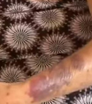 Avó de Rico Melquiades denuncia violência cometida pelo ex-genro