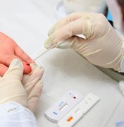 AL registra 209 casos e 14 mortes por hepatites virais nos primeiros nove meses de 2024