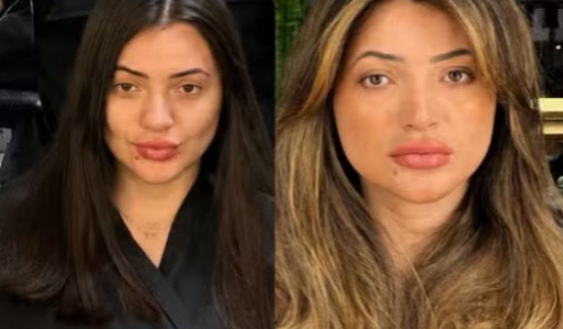 Veja antes e depois de suspeita de dar facada em cabeleireiro em SP
