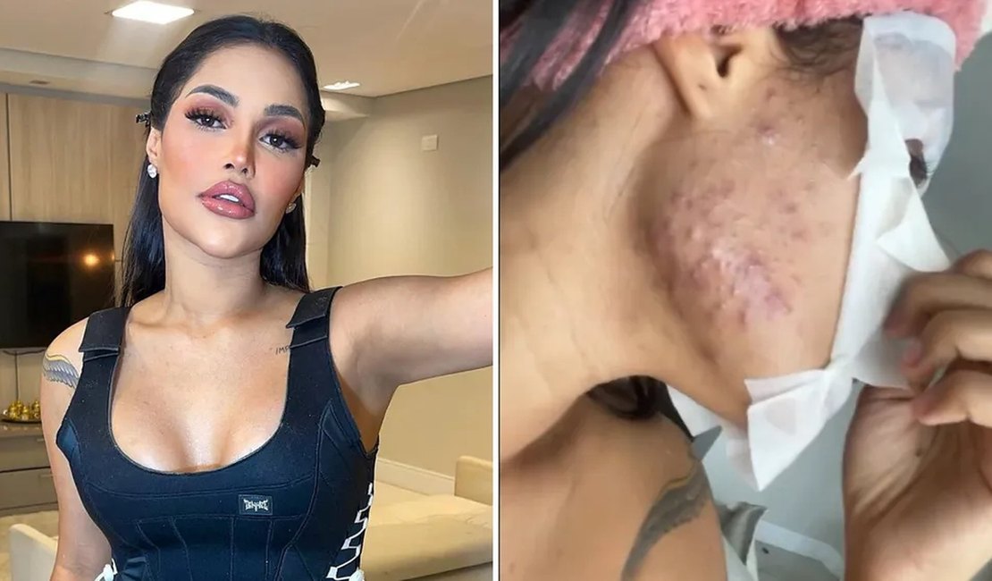 Flay diz que ganhou 10 kg e espinhas com 'chip da beleza': 'Foi o chip da feiura'