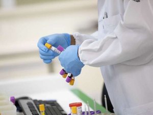 Alagoas tem 88.880 casos da Covid-19 e 2.144 óbitos