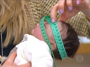ALE e Câmara debaterão políticas para crianças com a Síndrome Congênita do Zika