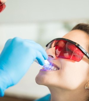 Uso de clareamento dental é seguro e não enfraquece os dentes, afirmam especialistas
