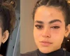 'Mosquinha parece ser inofensiva, mas não é', diz jovem que viralizou após infecção ocular