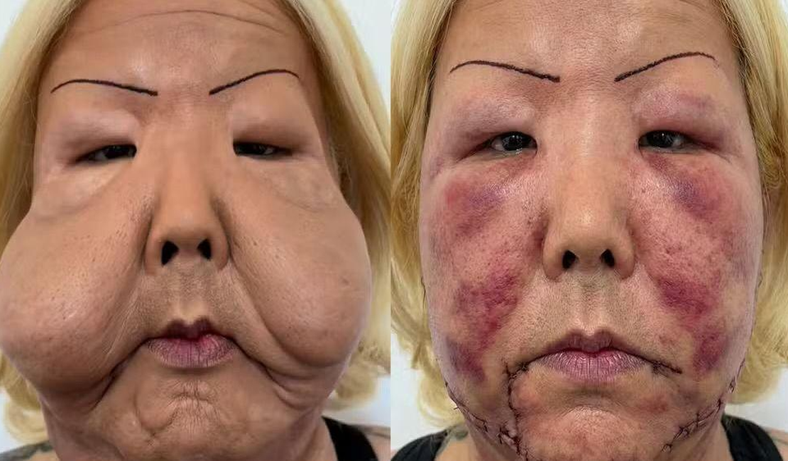 Conheça Juju do Pix, influenciadora que passa por reconstrução facial
