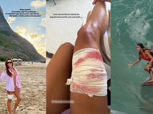 Turista é mordida por tubarão durante mergulho em Fernando de Noronha