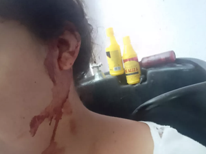 Mulher leva mordida na orelha após reclamar de som alto