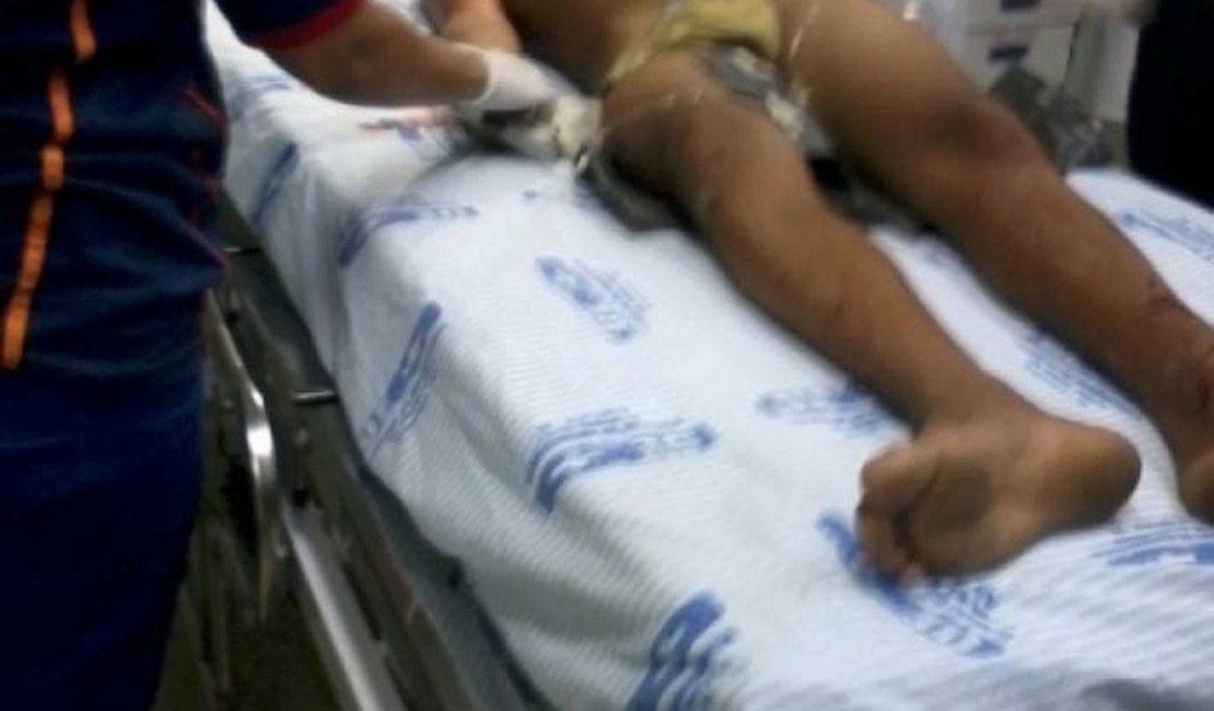 Adolescente que sofreu tentativa de homicídio morre na UE