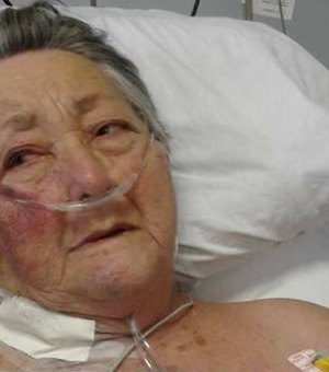 'Ele me bateu até cansar', diz idosa agredida por enfermeiro em UTI