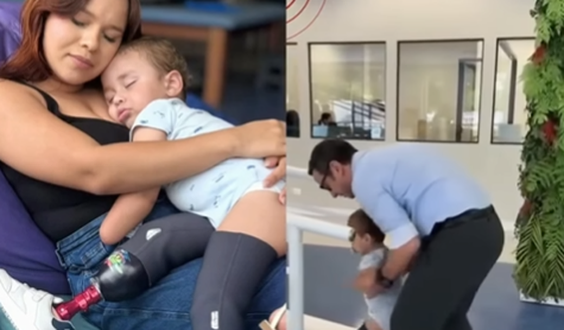 Após desvio de R$ 113 mil pelo pai, bebê amputado de Murici começa a andar com próteses