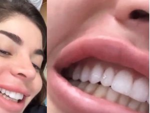 Gkay coloca diamante no dente: 'Ficou mais caro beijar minha boca'