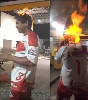 [Video] Para matar o coronavírus, homem ateia fogo na própria cabeça