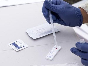 Planos de saúde não são mais obrigados a cobrir teste de sorologia de Covid-19, determina Justiça