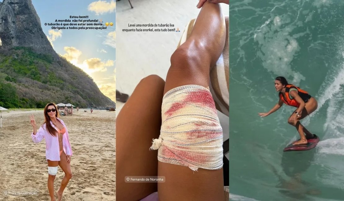 Turista é mordida por tubarão durante mergulho em Fernando de Noronha