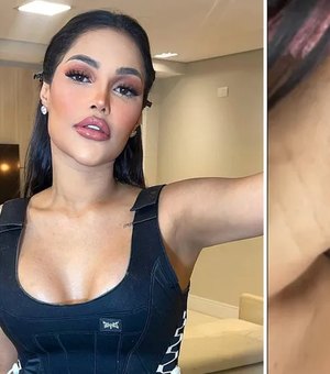 Flay diz que ganhou 10 kg e espinhas com 'chip da beleza': 'Foi o chip da feiura'