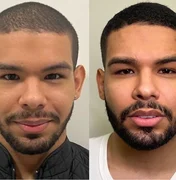 Ex-BBB Vyni ganha elogios após harmonização facial e é comparado com Drake