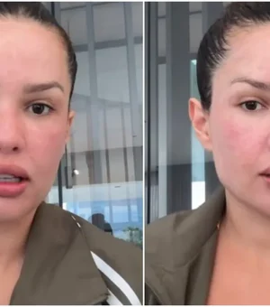 Juliette mostra rosto após procedimento com esperma de salmão; veja