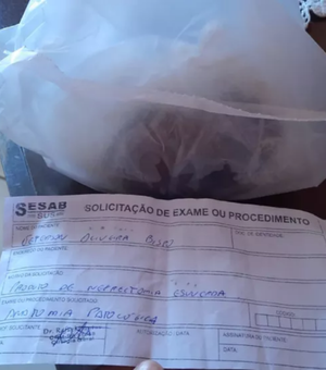Jovem perde rim após ser baleado e hospital entrega órgão à família em saco plástico na Bahia